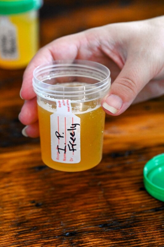 hand holding yellow Specimen cocktail in specimen container with green lid